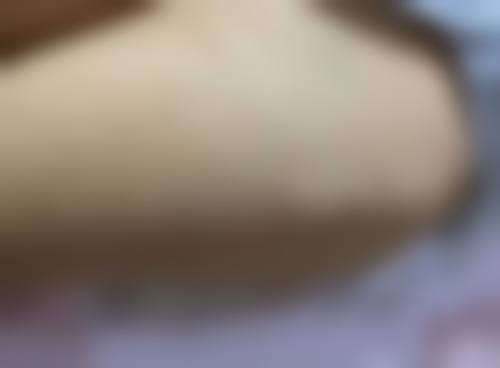 邹锐医生简介做手术价格