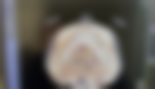 俞律峰医生做手术价格