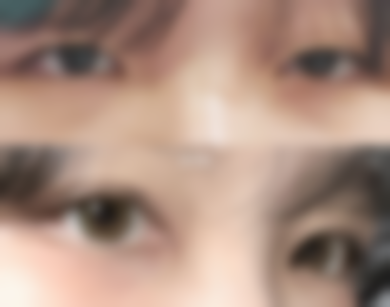 如何更有效的用护肤品去眼袋：成分党必看