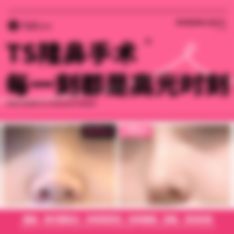 上海、广州面部抽脂一般要多少