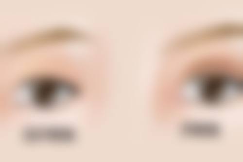 刘志高医生怎么挂号