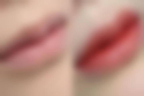 陆金龙医生简介之做手术价格