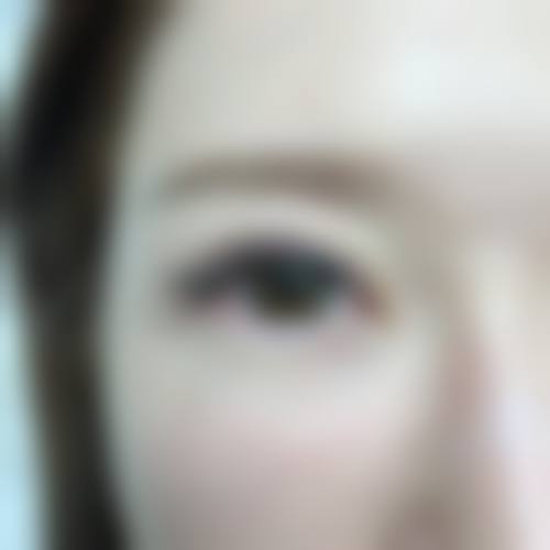 上海新极点整形医院真实患者口碑评价