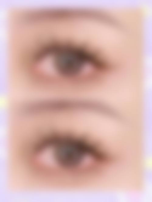 七、成都惠子医疗美容医院怎么样——口碑好不好？附真实患者口碑评价