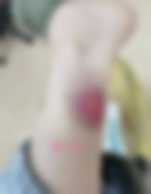 深圳回来整形医疗美容门诊部价格表