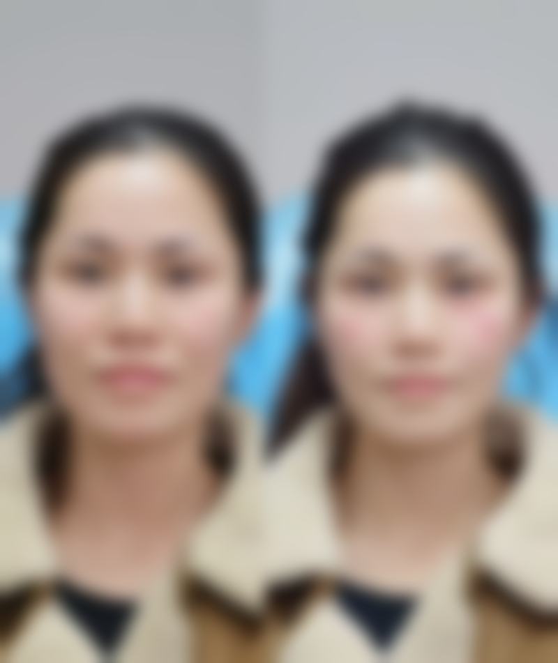 深圳回来整形医疗美容门诊部顾客实例