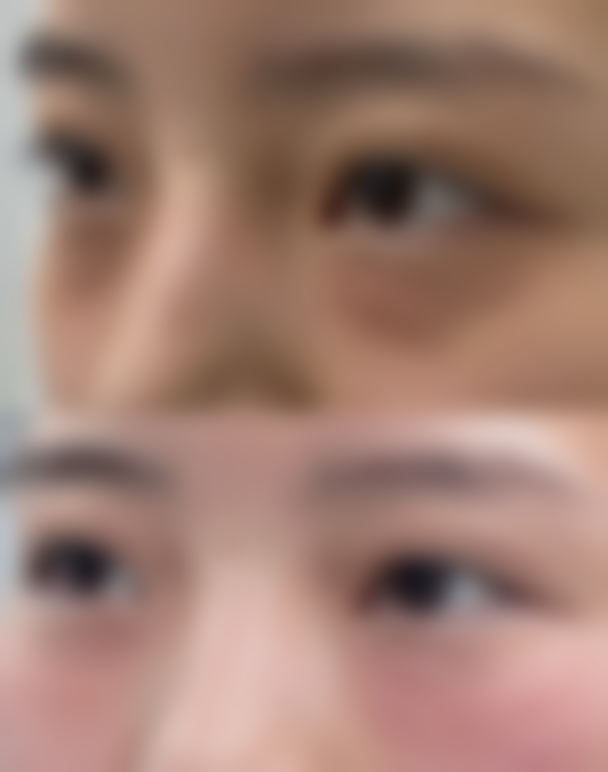 处女膜修复医院与留疤概率