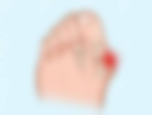 七毫米的双眼皮会成内双吗——消失时间线预警