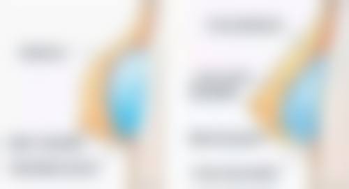 红霉素软膏涂新生疤痕处的可行性分析：成效显著可行