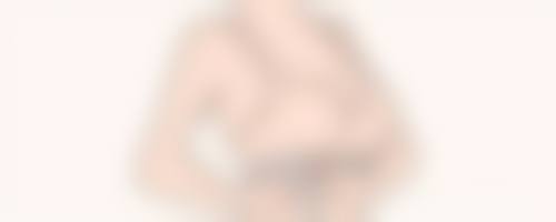 七毫米的双眼皮会成内双吗——变内双后修复秘籍