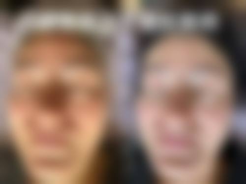 李增贵医生简介项目优势