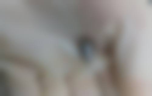 西安碑林晗美印象整形医疗美容诊所可靠吗