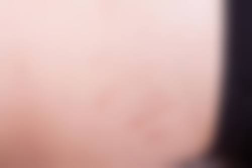 徐刚强医生简介项目优势