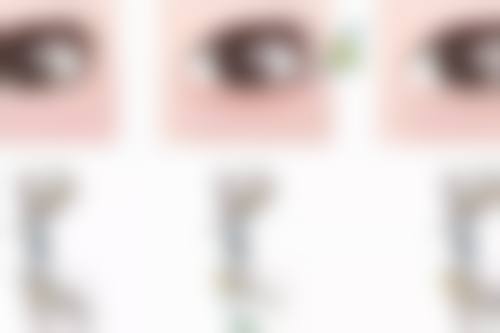 兰州五洲医院：早期疤痕增生的干预技巧