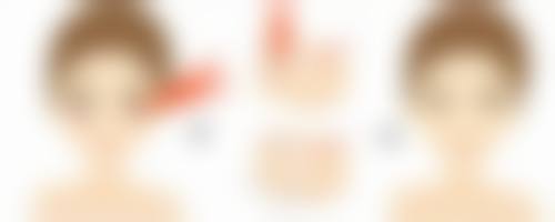 怎么样可以治疤痕之凹陷性疤痕：成都医附大医院ADM技术让肌肤“平”步青云