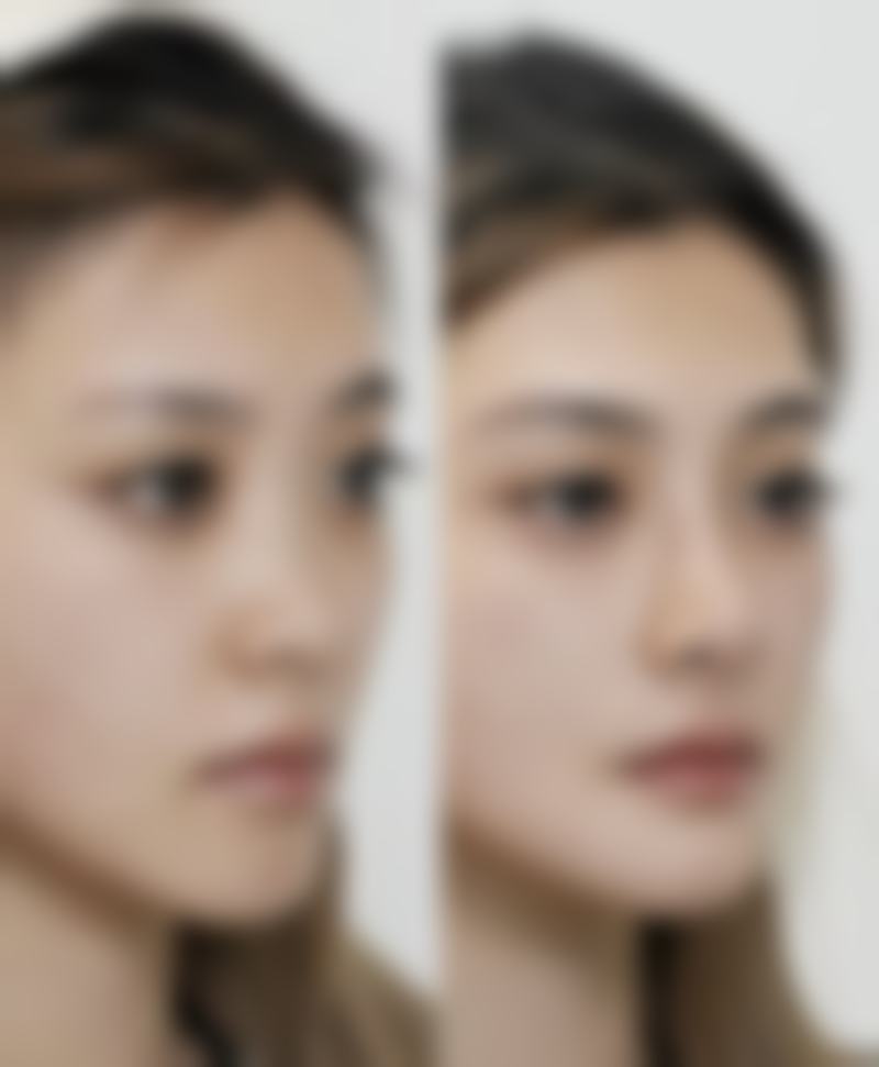 张云松医生简介项目优势