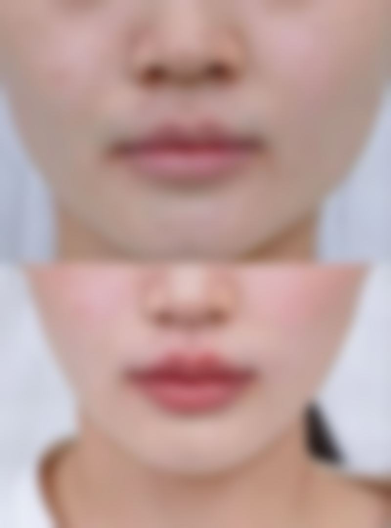 徐菲医生简介项目优势