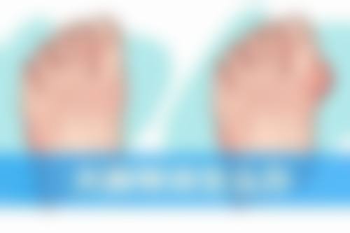 长期坚持的惊喜成效：见证每天眼部按摩的神奇蜕变