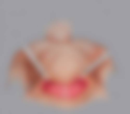 重度眼袋黑眼圈可以自愈吗：综合治疗是关键