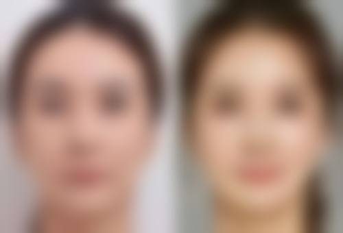 眼睛的眼袋怎么解决之眼霜使用秘籍