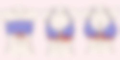 按摩去眼袋常见问题解答：打消每天眼部按摩的疑虑