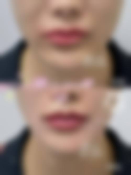 洛阳黄学峰整形医院价格表