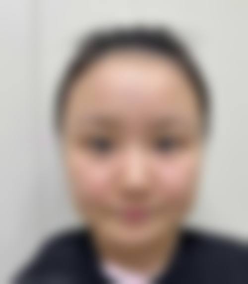 北京悦然整形医院口碑好不好？附真实患者口碑评价