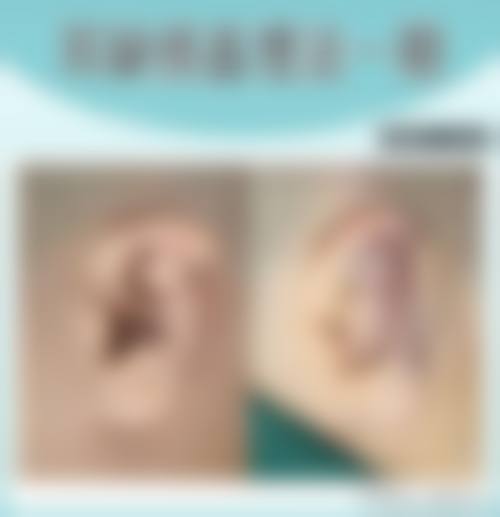 洛阳黄学峰整形医院口碑好不好？附真实患者口碑评价