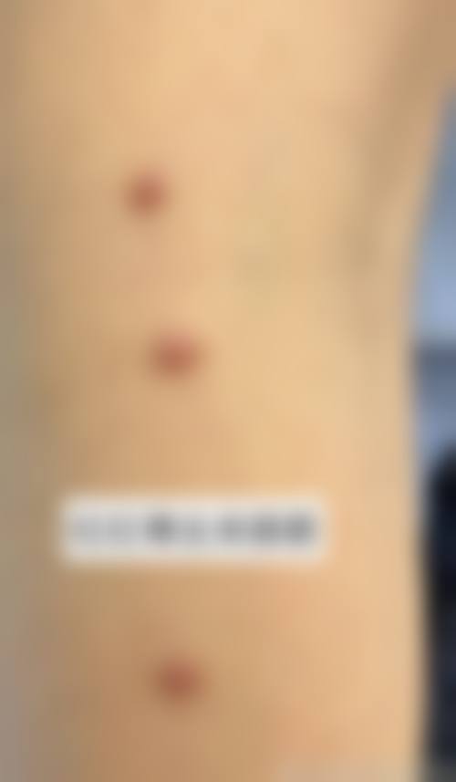 北京悦然整形医院项目特色