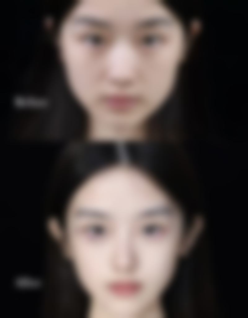 眼睛的眼袋怎么解决之日常护理全攻略