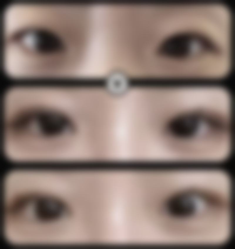 张晓东医生简介做手术价格