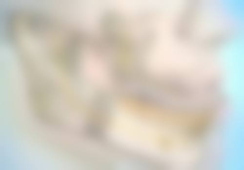 切开双眼皮多长时间恢复？术后肿胀期7天拆线，自然状态需3-6个月