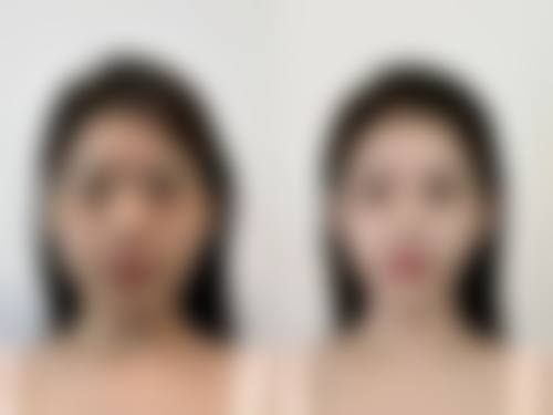 重庆佳兰博美汇医疗美容诊所怎么样，评价