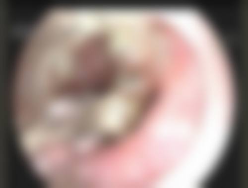 裴仁镐医生口碑如何