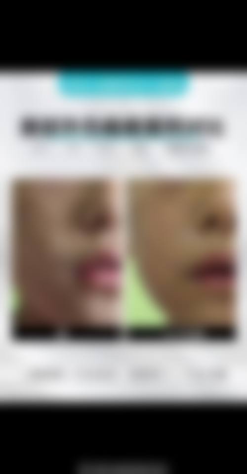 济南西子医疗美容门诊部特色项目怎么样