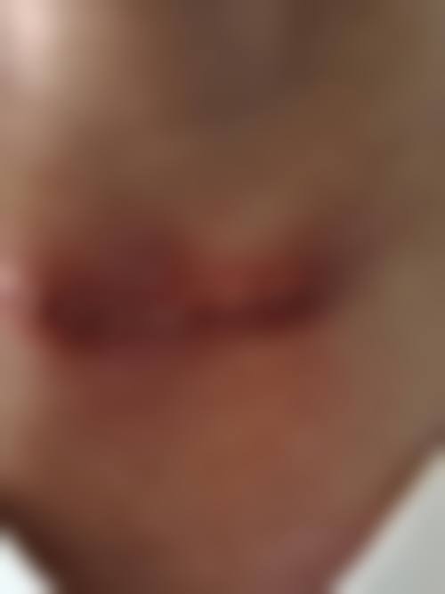 济南西子医疗美容门诊部顾客实例