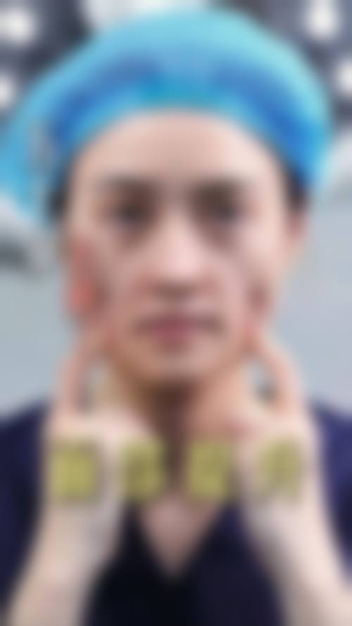 赵远党医生简介做手术价格