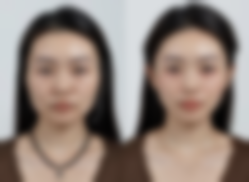 四、假体隆胸喂奶会下垂吗：哺乳期特别护理秘籍