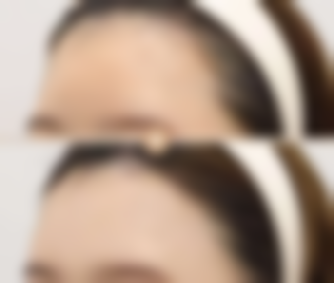 滴眼液能去眼袋吗？揭秘七叶洋地黄双苷滴眼液效果+正确使用方法