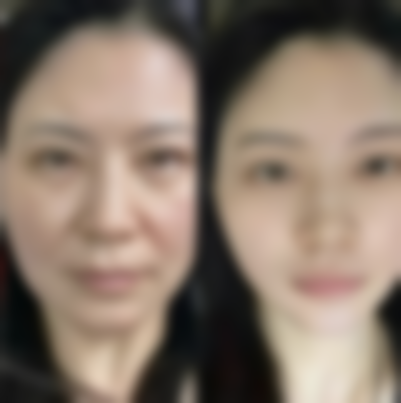 张新华医生项目优势