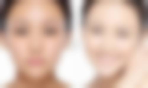 注射隆胸哪种材料好之如何选择更适合你的隆胸材料？