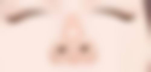 怎么祛除凹洞疤痕：各医院介绍其他祛疤方法大比拼