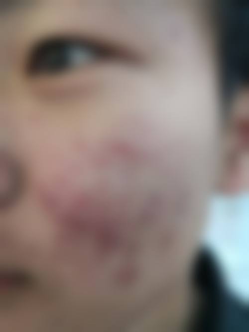 陈银东医生口碑好不好