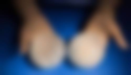 蔡黔医生项目优势