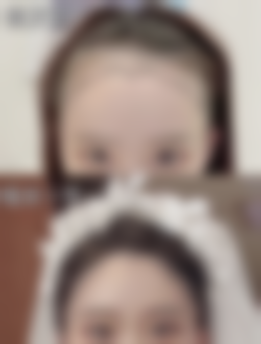 隆鼻碰到了会怎么样——大力碰撞：当“意外”变成“灾难”