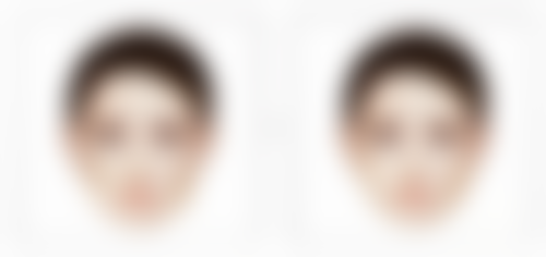 如何去缝针后的疤痕疙瘩:医院选择——专精机构事半功倍