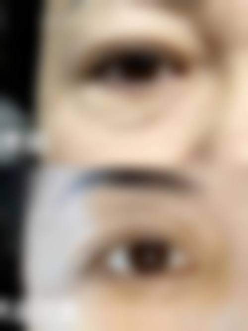 魏晓峰医生简介做手术价格