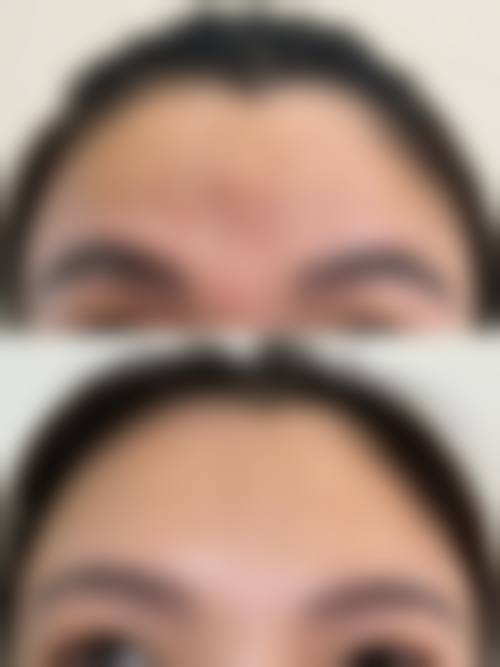 袁耀东医生项目优势