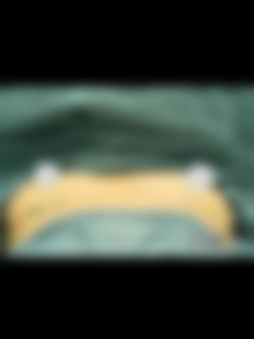 丽延k怎么样，抖音团购活动和价格表