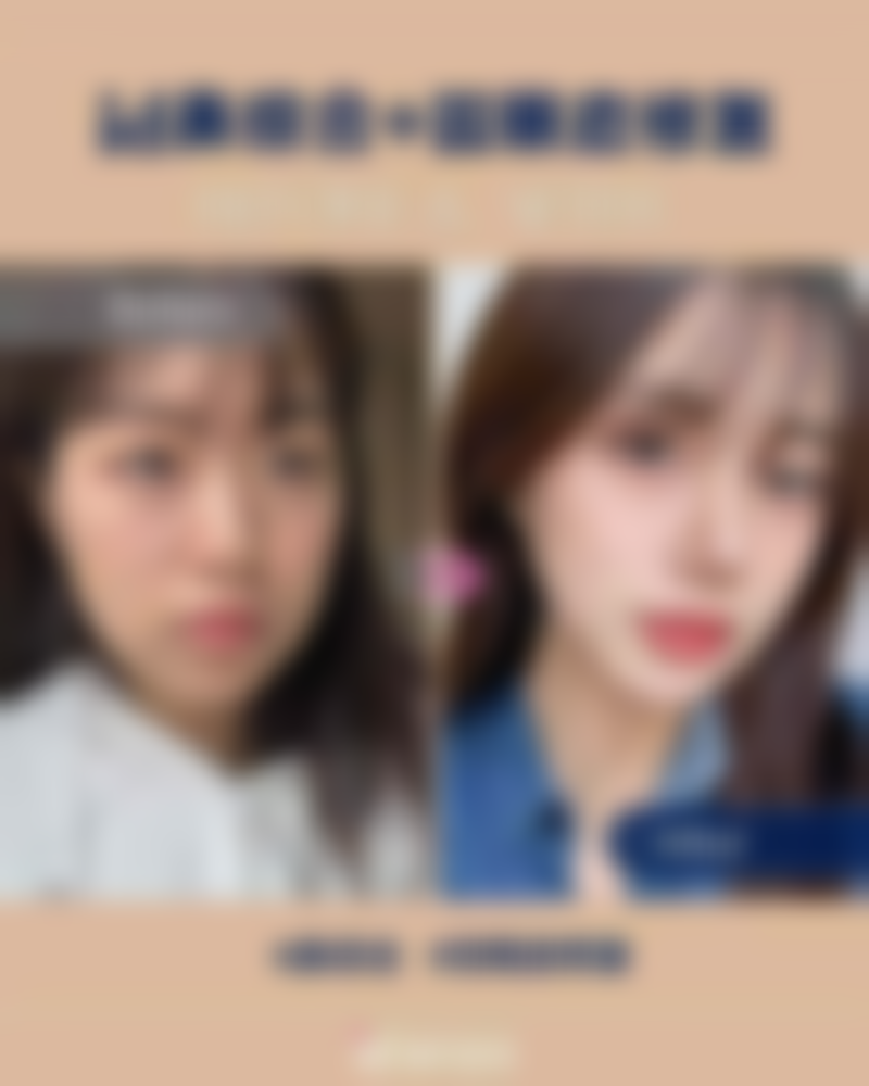 大连何氏鼻医疗美容门诊部更擅长什么